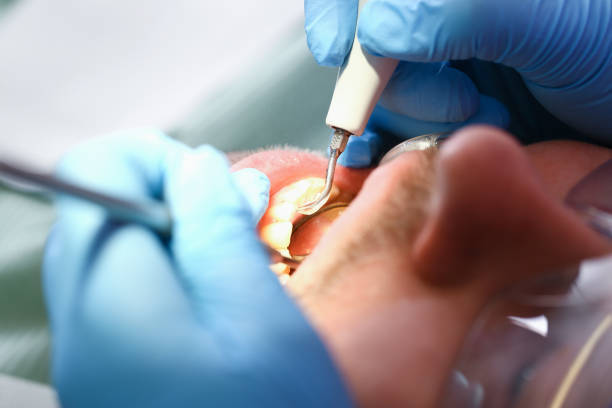 Best Pediatric Emergency Dentist in Willow Creek, CA