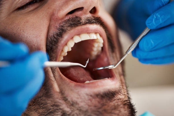 Best Emergency Denture Repair in Willow Creek, CA